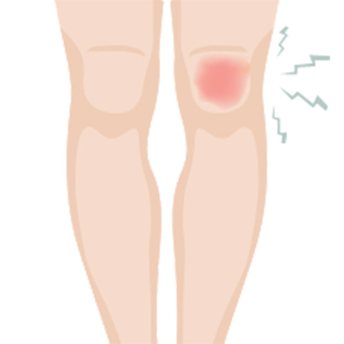 各関節の歩行時痛